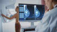Patient in background having a mammogram done; clinician in foreground reviewing scans.